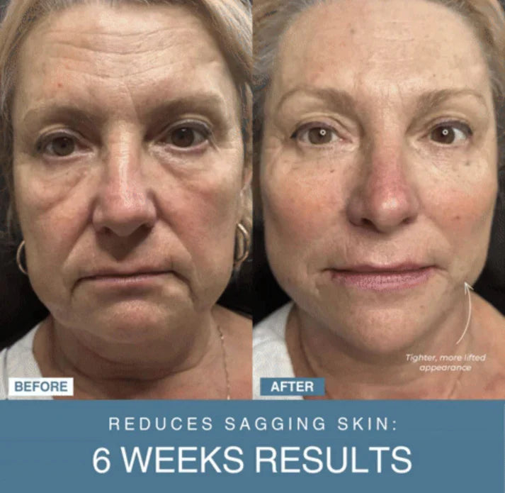 Lulu & Bloom™ 7-in-1 LED Anti-Aging/Wrinkle Apparatus