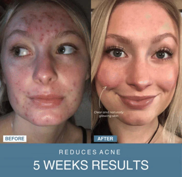 Lulu & Bloom™ 7-in-1 LED Anti-Aging/Wrinkle Apparatus